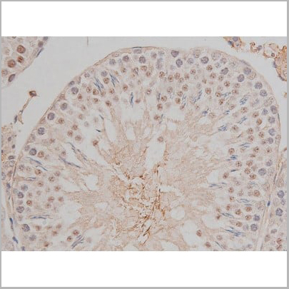 product-image-AAA30991_IHC18.jpg
