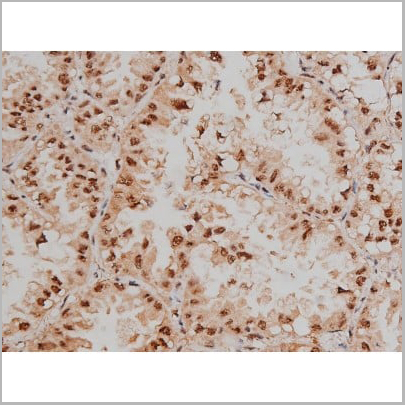 product-image-AAA30991_IHC3.jpg
