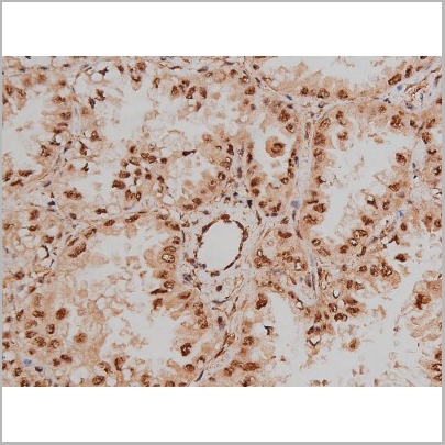 product-image-AAA30991_IHC4.jpg