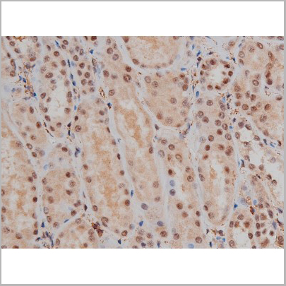 product-image-AAA30991_IHC5.jpg