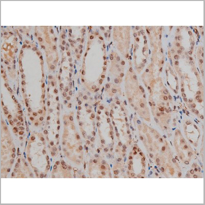 product-image-AAA30991_IHC6.jpg
