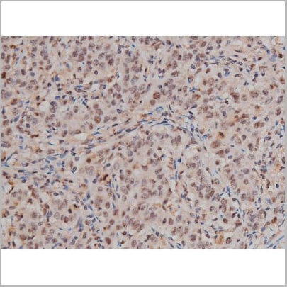 product-image-AAA30991_IHC7.jpg