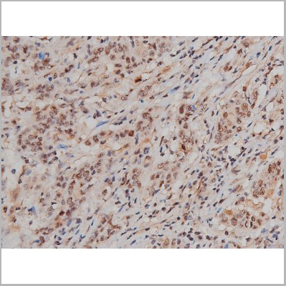 product-image-AAA30991_IHC8.jpg