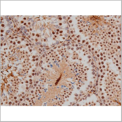product-image-AAA30991_IHC9.jpg