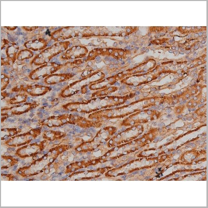 product-image-AAA30992_IHC11.jpg