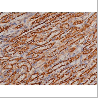 product-image-AAA30992_IHC12.jpg