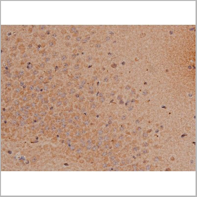 product-image-AAA30992_IHC13.jpg
