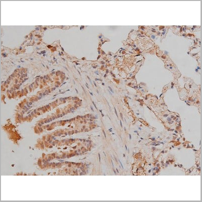 product-image-AAA30992_IHC14.jpg
