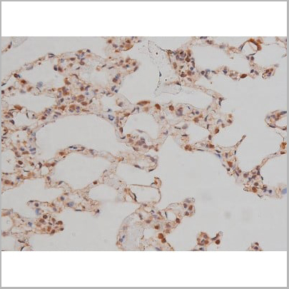 product-image-AAA30992_IHC15.jpg