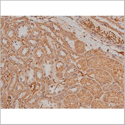 product-image-AAA30992_IHC16.jpg