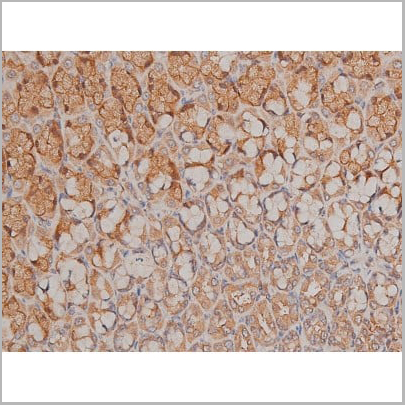 product-image-AAA30992_IHC18.jpg