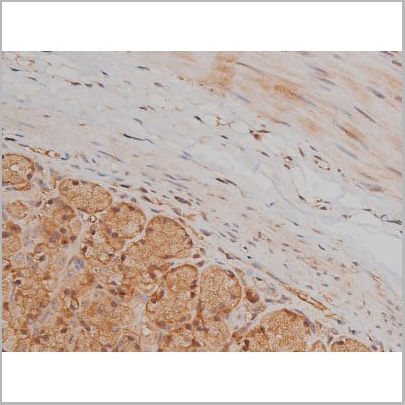 product-image-AAA30992_IHC20.jpg