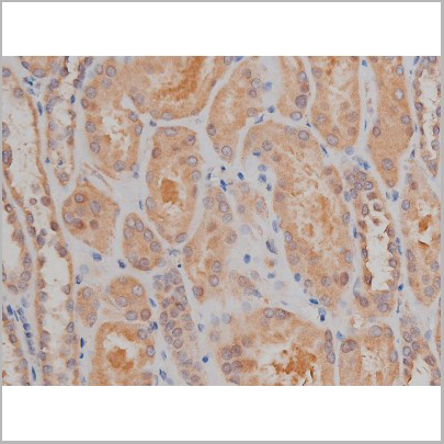 product-image-AAA30992_IHC3.jpg