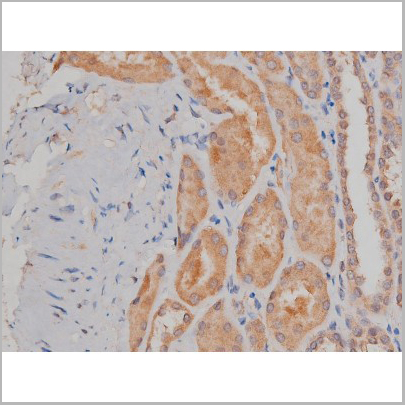 product-image-AAA30992_IHC4.jpg