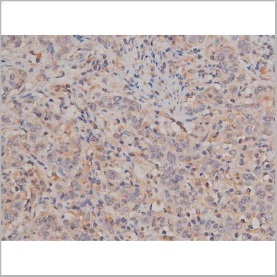 product-image-AAA30992_IHC5.jpg