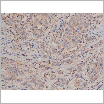 product-image-AAA30992_IHC6.jpg