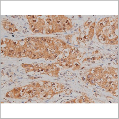product-image-AAA30992_IHC7.jpg
