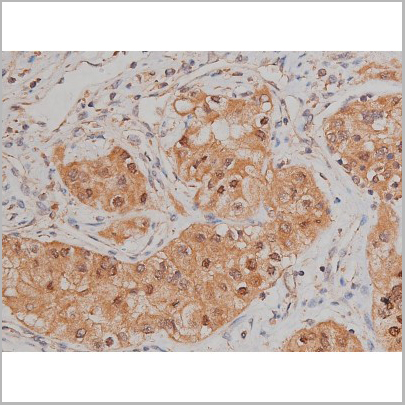 product-image-AAA30992_IHC8.jpg