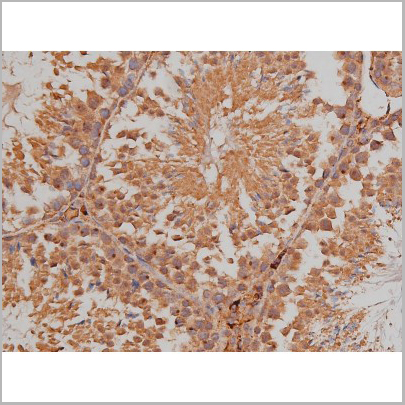 product-image-AAA30992_IHC9.jpg
