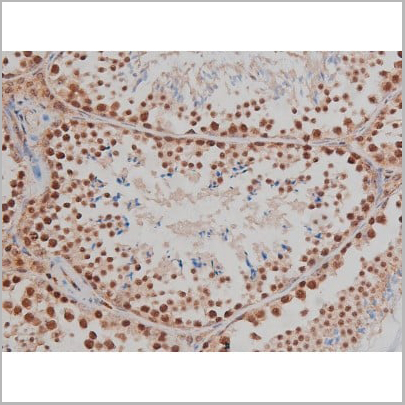 product-image-AAA30993_IHC10.jpg
