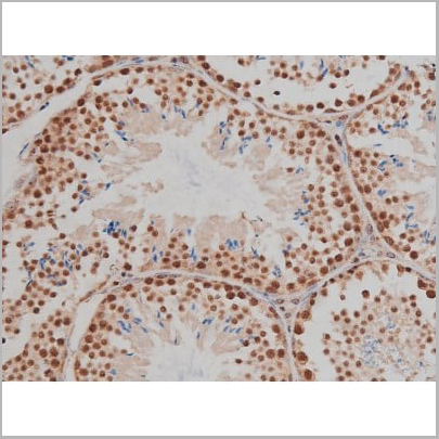 product-image-AAA30993_IHC11.jpg