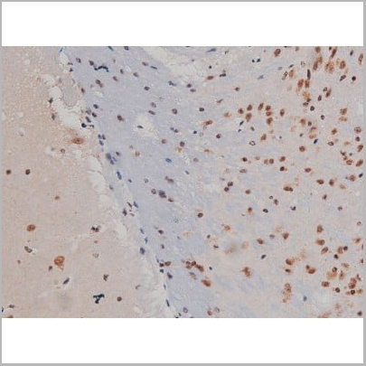 product-image-AAA30993_IHC12.jpg