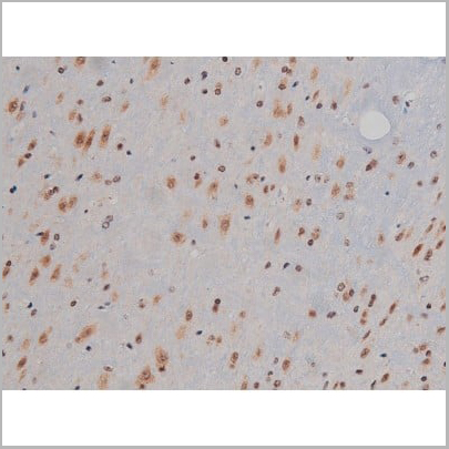 product-image-AAA30993_IHC13.jpg