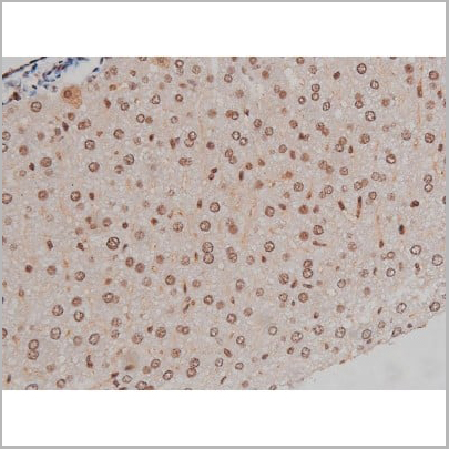 product-image-AAA30993_IHC14.jpg