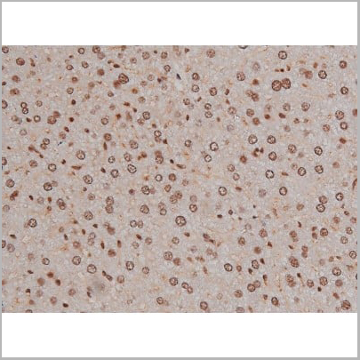 product-image-AAA30993_IHC15.jpg