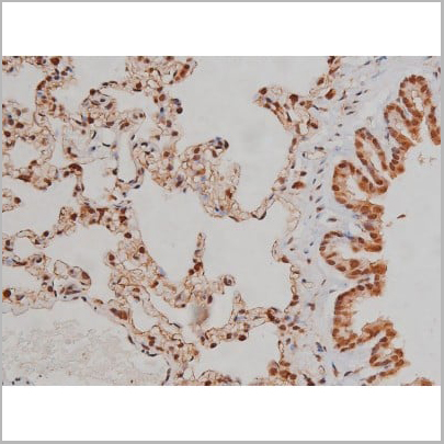 product-image-AAA30993_IHC16.jpg