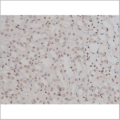 product-image-AAA30993_IHC18.jpg