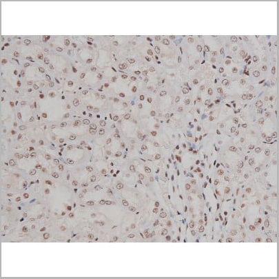 product-image-AAA30993_IHC19.jpg