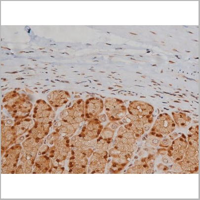 product-image-AAA30993_IHC20.jpg
