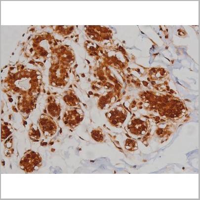 product-image-AAA30993_IHC4.jpg