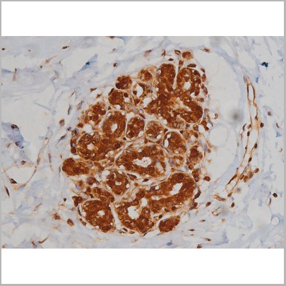 product-image-AAA30993_IHC5.jpg
