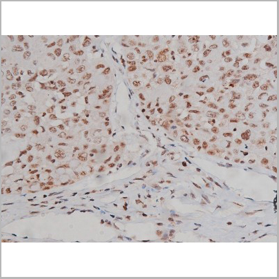 product-image-AAA30993_IHC6.jpg