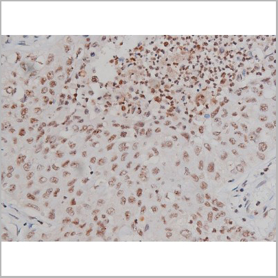 product-image-AAA30993_IHC7.jpg