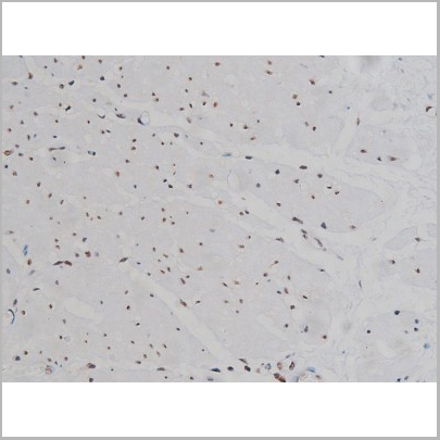 product-image-AAA30993_IHC9.jpg