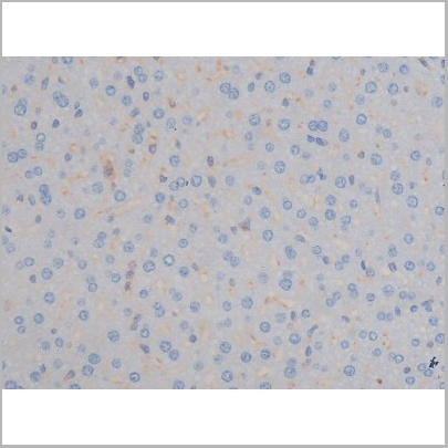 product-image-AAA30994_IHC4.jpg