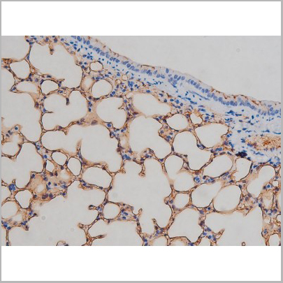 product-image-AAA30994_IHC5.jpg