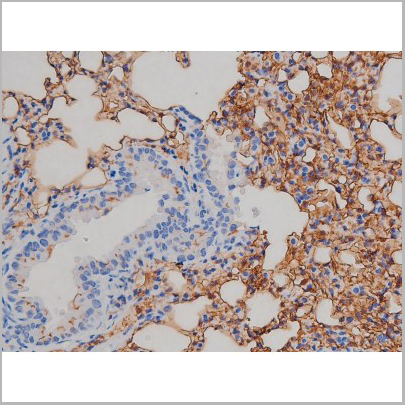product-image-AAA30994_IHC6.jpg