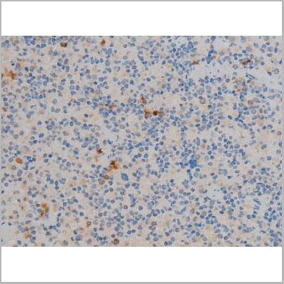 product-image-AAA30995_IHC11.jpg