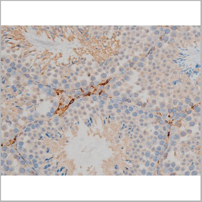 product-image-AAA30995_IHC2.jpg