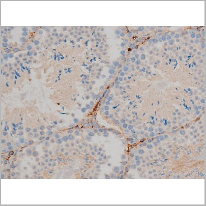 product-image-AAA30995_IHC3.jpg