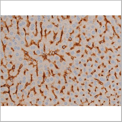 product-image-AAA30995_IHC4.jpg