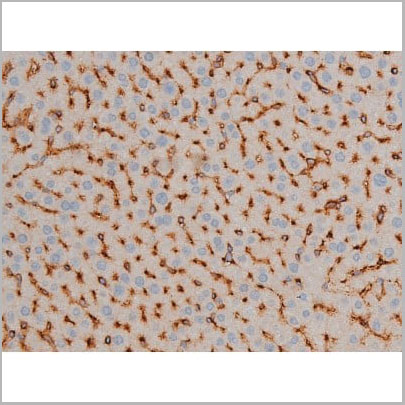 product-image-AAA30995_IHC5.jpg
