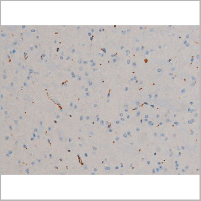 product-image-AAA30995_IHC6.jpg