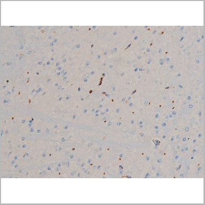 product-image-AAA30995_IHC7.jpg