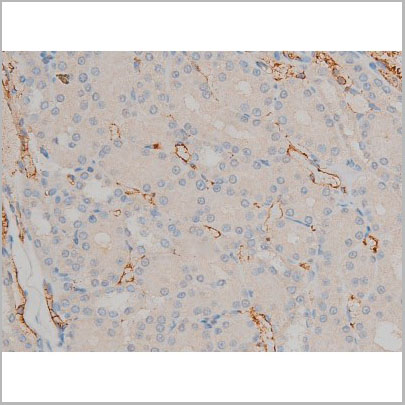 product-image-AAA30995_IHC8.jpg