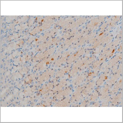 product-image-AAA30995_IHC9.jpg